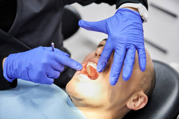 Best Emergency Dental Care for Sports Injuries in Martin, SD